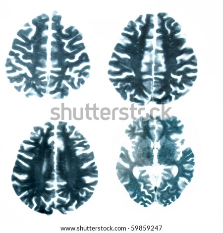 scan human brain magnetic resonance (MR) pro isolated on white background