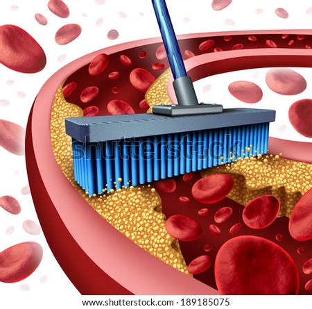 Cleaning arteries concept as a broom removing plaque buildup in a clogged artery as a symbol of atherosclerosis disease medical treatment opening clogged veins as a metaphor for removing cholesterol.