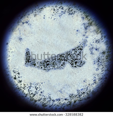 A simulated view through a microscope on bacterias in the shape of Prince Edward Island.(series)