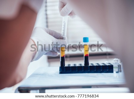 platelet rich plasma preparation pdf