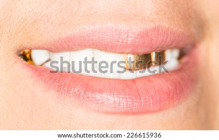 gold teeth girl
