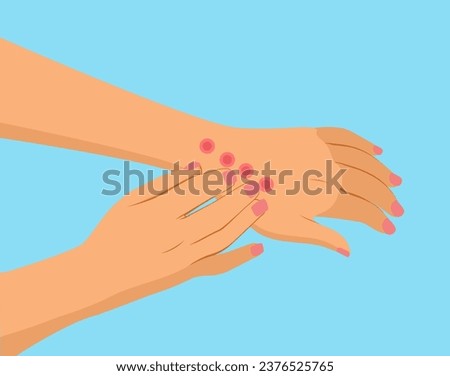 Patient with bed bug bite vector illustration on blue background. Arms with rash cartoon drawing
