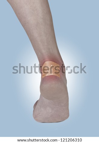 Adhesive Healing plaster on the heel. Concept photo with Color Enhanced skin with read spot indicating location of the wound.