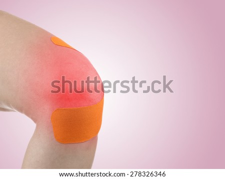 Knee treated with tex tape therapy.