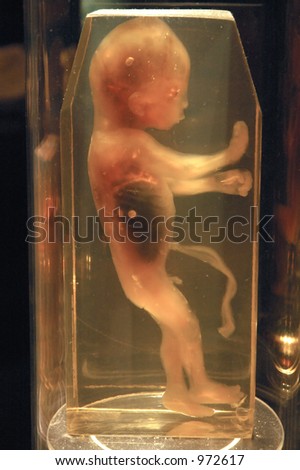 6 Month Old Fetus Stock Photo 972617 : Shutterstock