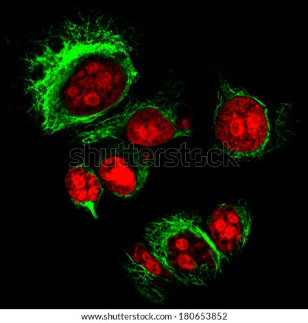 Epithelial tumor cells labeled with fluorescent dyes. Nucleus are in red, cytoskeleton filaments are in green