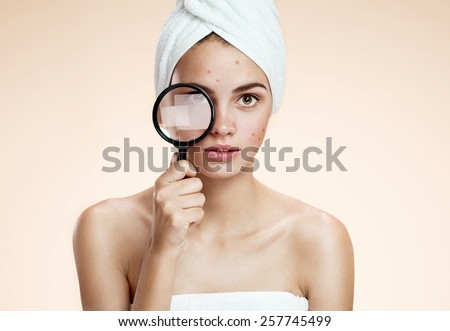 Woman with a pimply face holding magnifying glass. Woman skin care concept / photos of ugly problem skin brunette girl on beige background