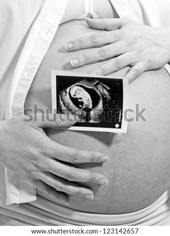 Pregnant woman holding ultrasound image in front of her belly