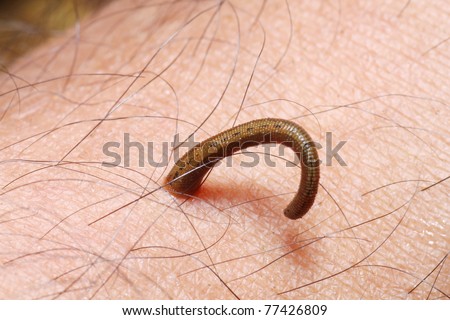 nature leech on human skin