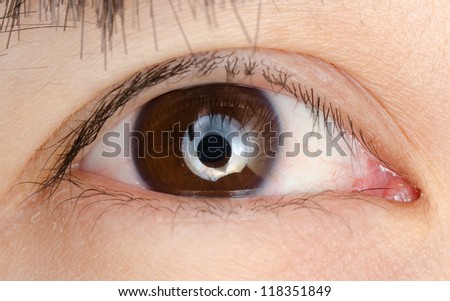 eye macro