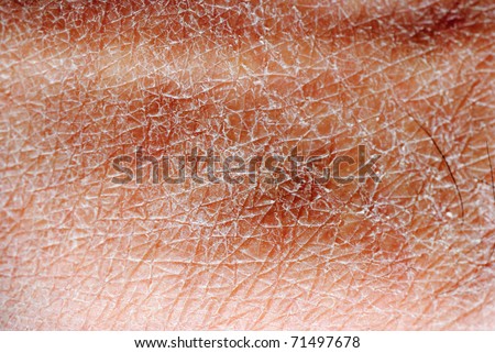 dry skin texture detail background