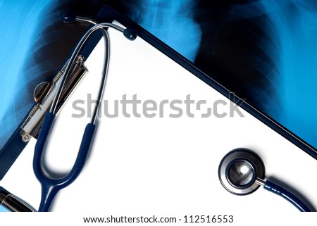 Stethoscope on empty clipboard and X-ray photo