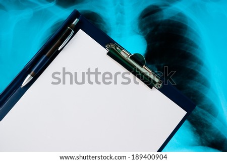 Empty document in a clipboard on Xray photo of lungs
