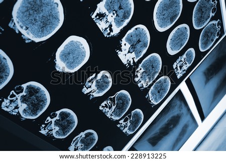 Scan of the brain and the skull and other radiography images