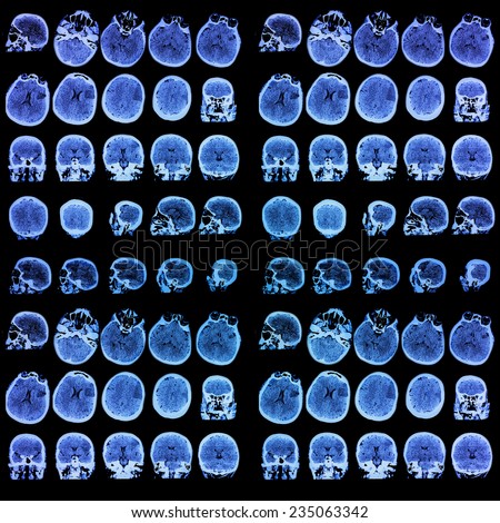 Photo of medical tomography. Medical background