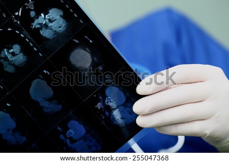 Doctor is working attentively analyzes patient data