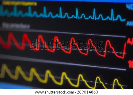 Waves ECG on the monitor in perspective