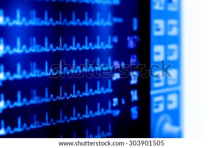 Medical monitor indicators of cardiac activity. Concept of surveillance