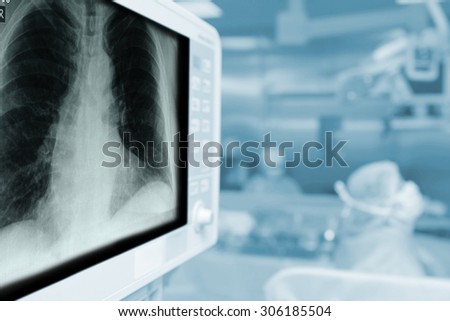 X-ray monitor during surgical operation with a blank space for your text