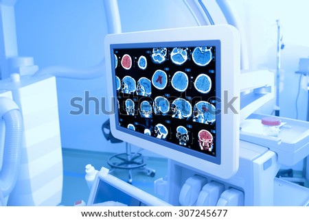 X-ray monitor in the hospital room