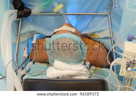 Patient in anesthesia. Natural truthful photo