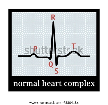 Normal Sinus Complex With The Name Of The Waves. Vector Illustration ...