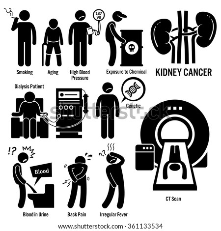 Kidney Cancer Symptoms Causes Risk Factors Diagnosis Stick Figure ...