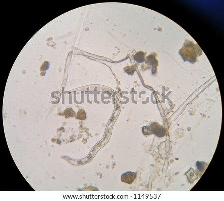 Nematode (tiny parasitic worm) under microscope