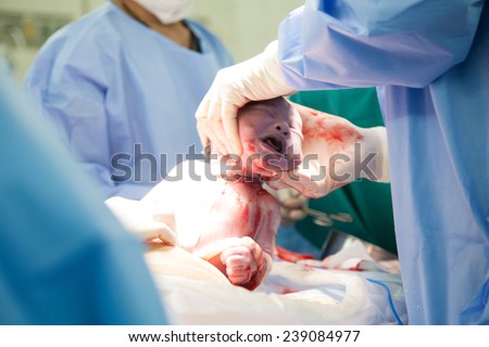 Doctor and nurse are  pulling a new born baby from mom's abdomen