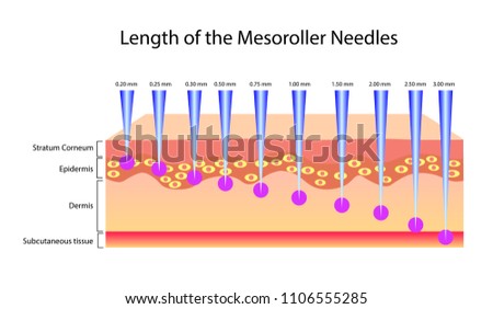 Length of the mesoroller needles, Vector illustration