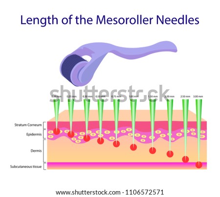 Length of the mesoroller needles, Vector illustration