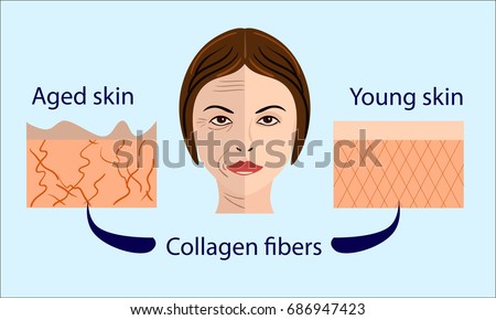 skin aging diagrams. young skin is firm tight, its collagen Vector illustration with a face and two types of skin - aged and young