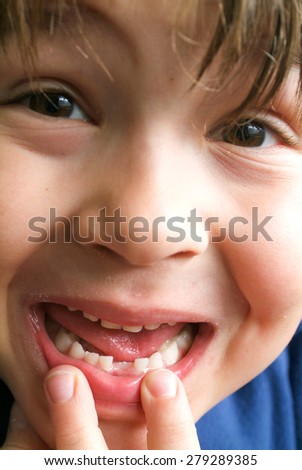 Close-up of a boy showing his missing tooth