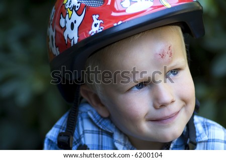 This boy was trying to bike for the first time, and ended up with his head on the streets... If only he had used his helmet!