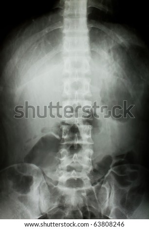 X-ray of the pelvis and spinal column.
