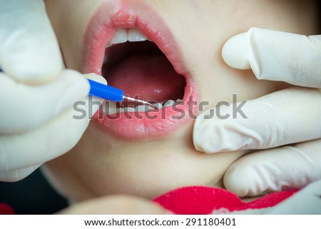 Close up Dentist examining a patient\'s teeth in the dentist