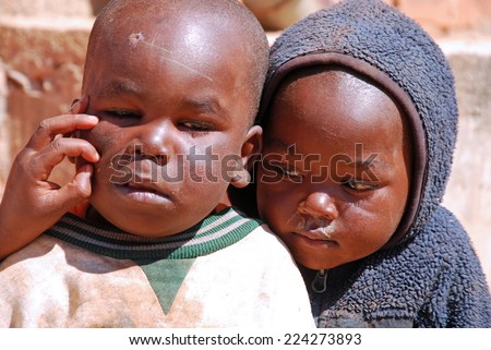 circa August 2014-Village of Pomerini - Tanzania- Africa- unidentified African children of the Franciscan Mission of Pomerini for humanitarian aid against AIDS while cleaning your face from dirt and scabs of the disease.