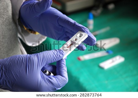 HIV test at Pomerini in Tanzania - Africa - A doctor examines the blood to find out the positive to the AIDS virus