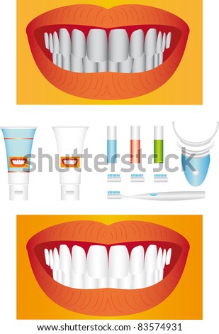 Beautiful young teeth before and after whitening.