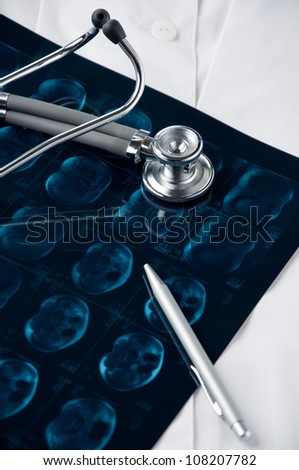 Tomography: MRI scan, stethoscope and pen on a doctor\'s smock