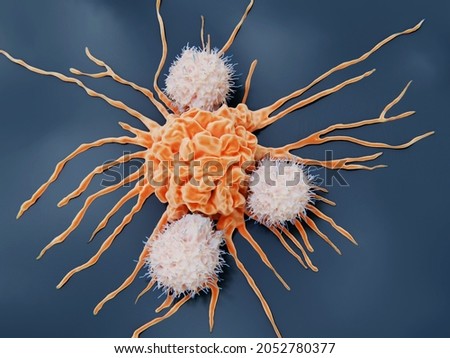Natural killer attacking a cancer cell. They  are lymphocytes that target virus infected cells and tumor  cells without deliberate immunization or activation. 3d illustration