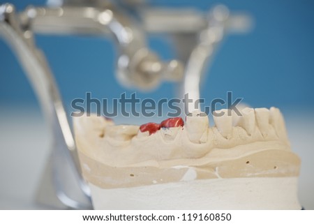 Model with dentures of teeth in dental laboratory