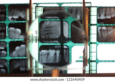 X-ray backgrounds, dental