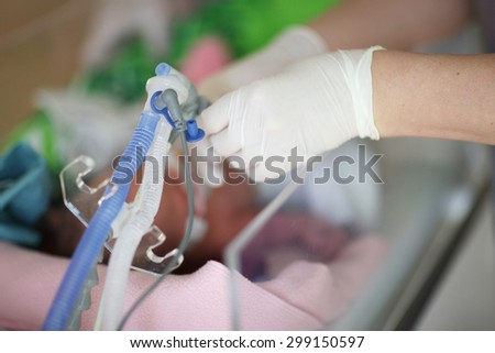 Invasive ventilation in premature baby