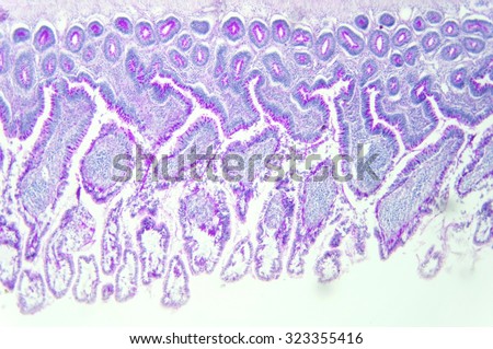 Small intestine wall Images - Search Images on Everypixel