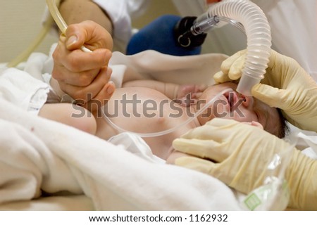 Oxygen delivery at the hospital after birth