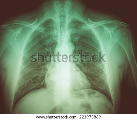 Vintage looking Medical X-rays