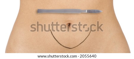stomach of young woman with surgery scalpel (digital composition; pure white background)