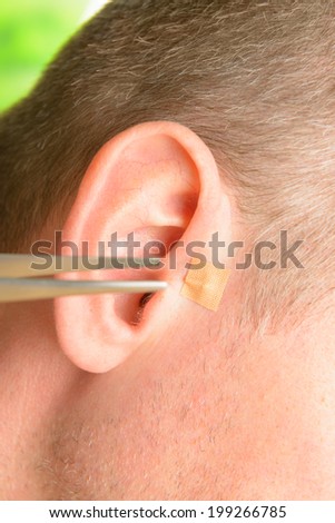 Auriculotherapy, or auricular therapy, or ear acupuncture, or auriculoacupuncture is a form of alternative medicine based on the idea that the ear is a microsystem which reflects the entire body.