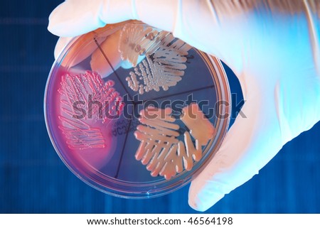 Hand in glove holding Petri plate with bacteria Escherichia Coli, Klebisiella Pneumoniae, Serratia Marascens